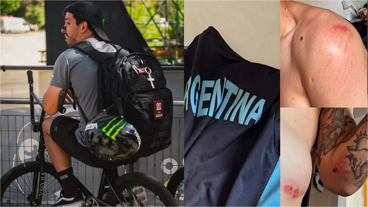 El Maligno Torres compartió como quedó “todo roto” después de la caída. Foto: @malignobmx