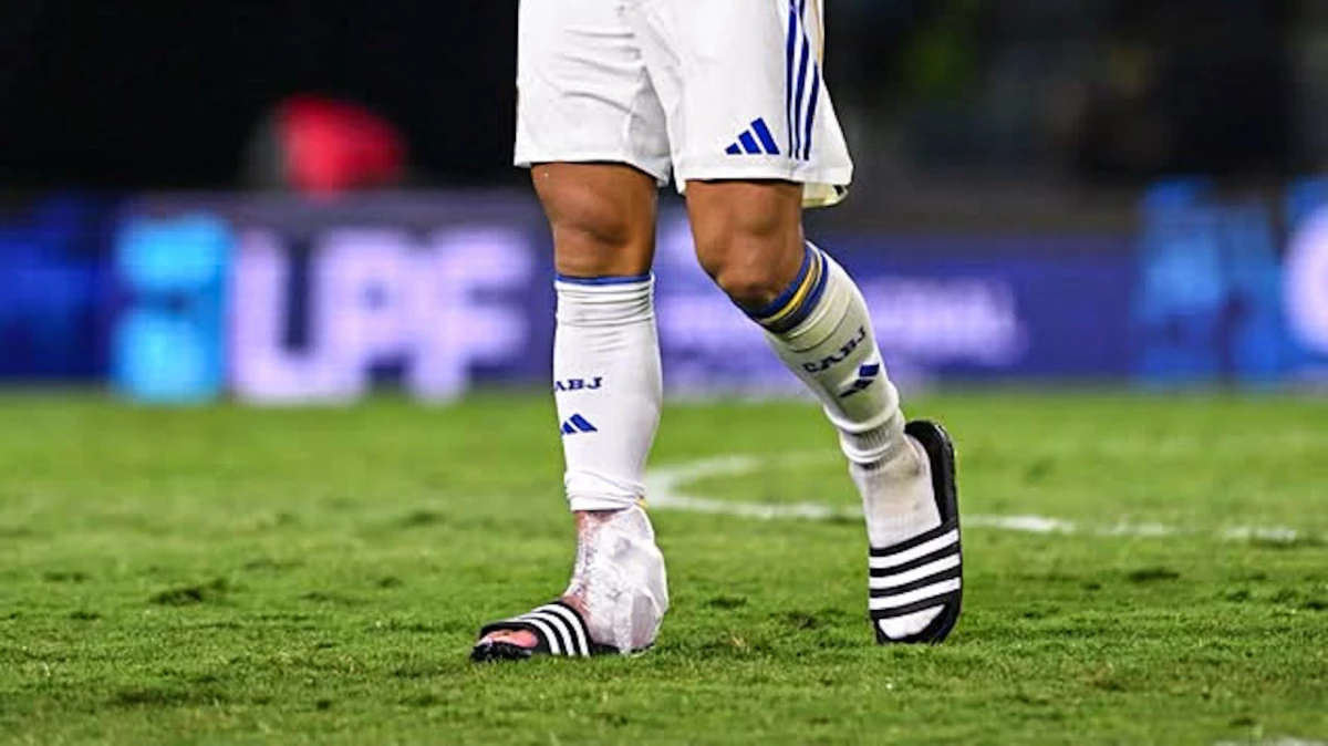 Foto: Prensa Boca. Paredes dejó la cancha con hielo en su tobillo derecho