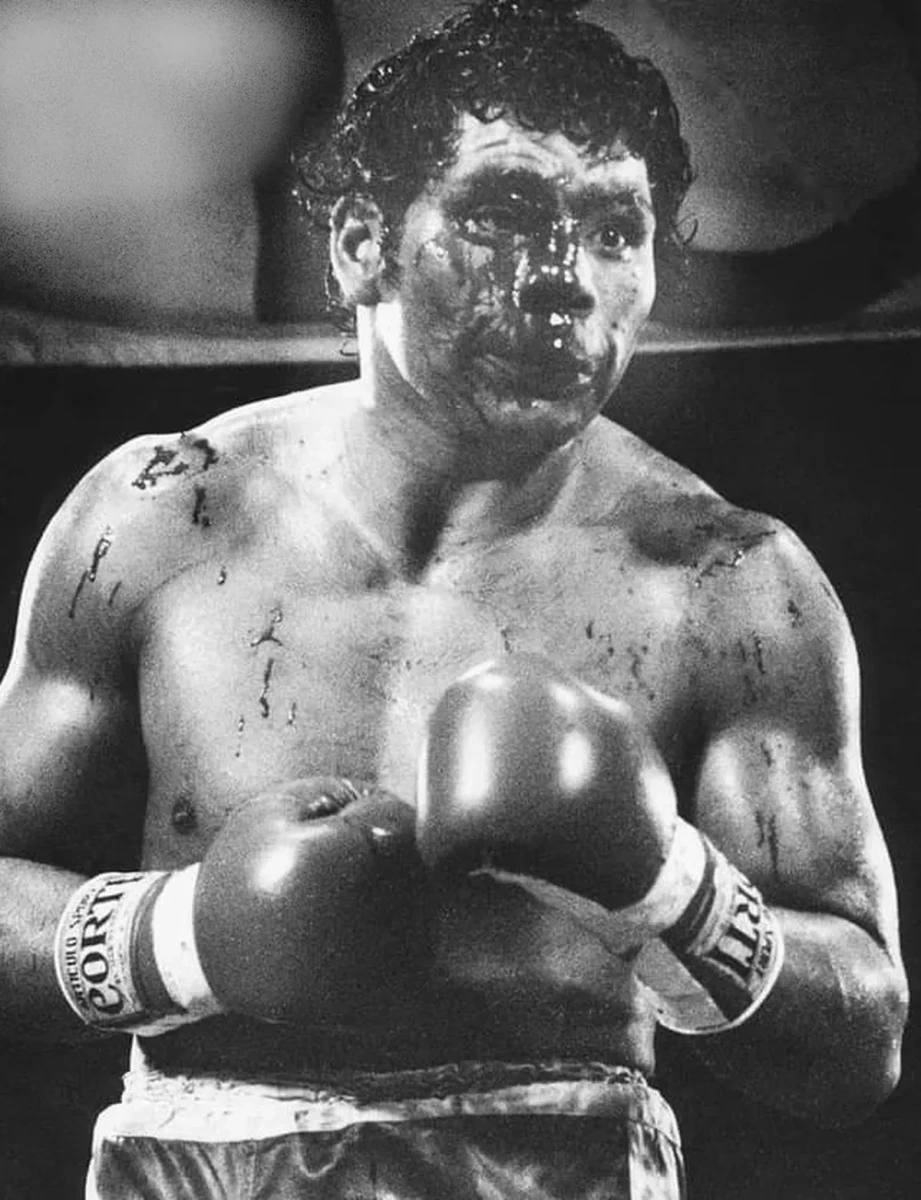 Foto: Revista El Gráfico. La sangre brotando de la cara. El argentino obtuvo un recordado triunfo por nocaut